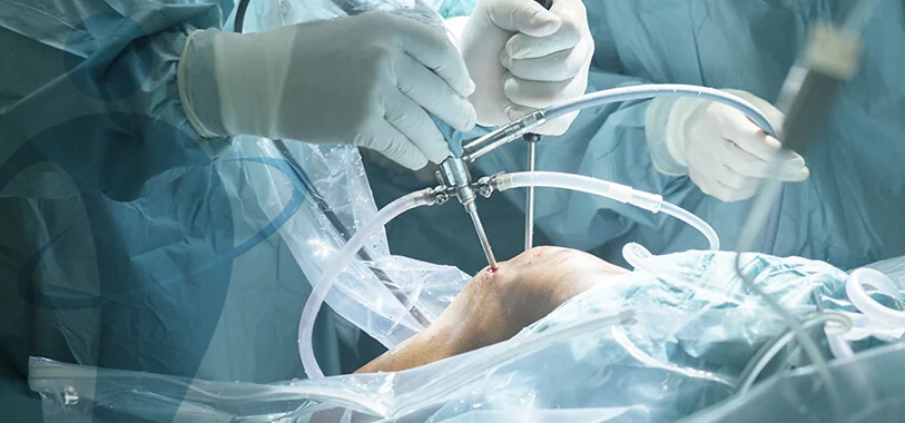 Cirurgia Ortopédica Geral